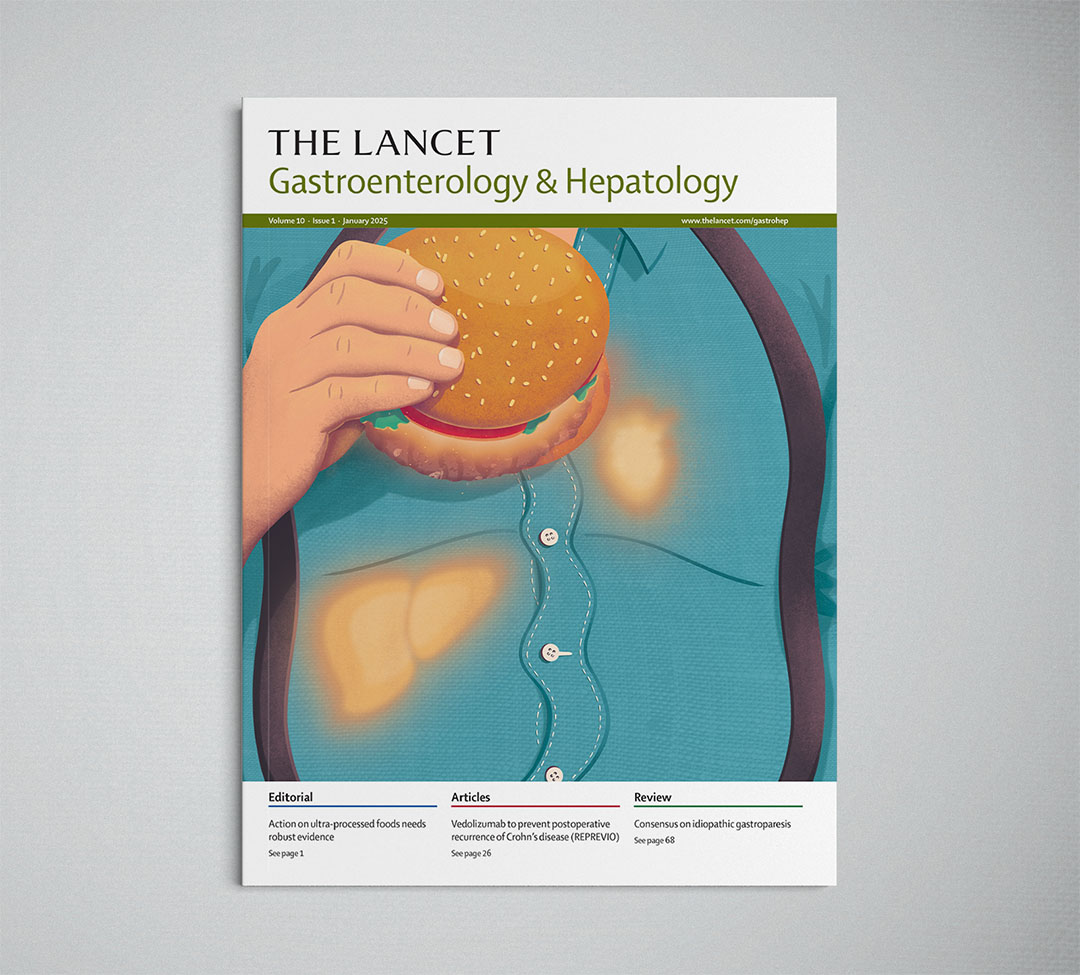 Masld and coronary artery disease